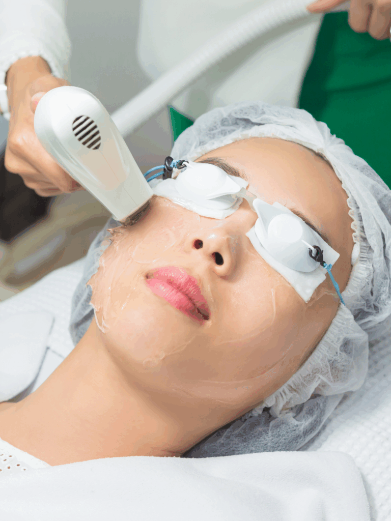 IPL Intense Pulse Light Therapy2