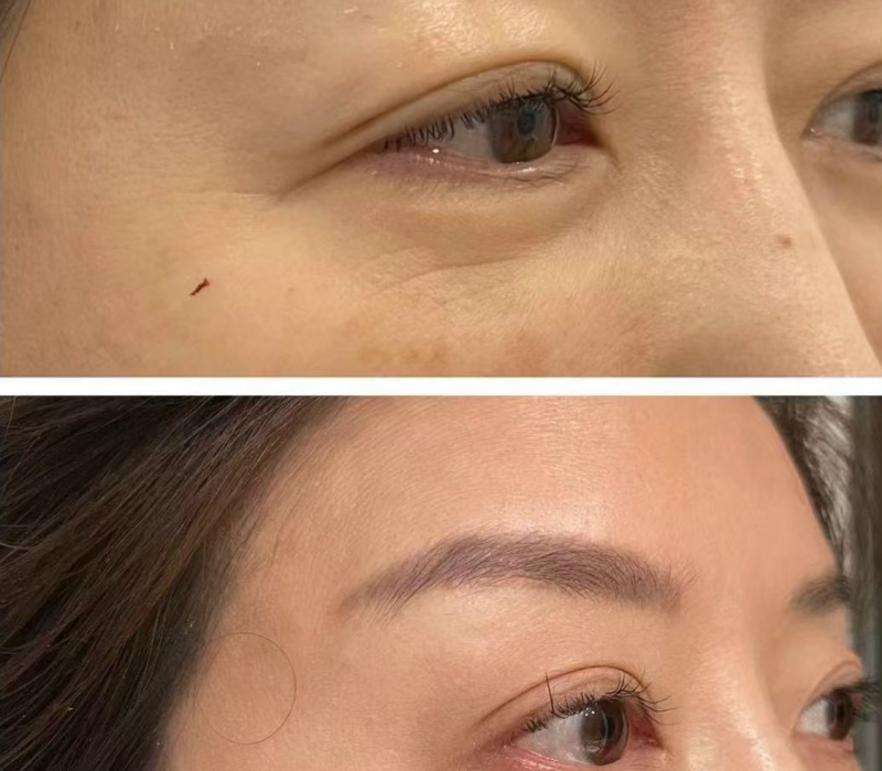 PLEXR Plasma Treatment2