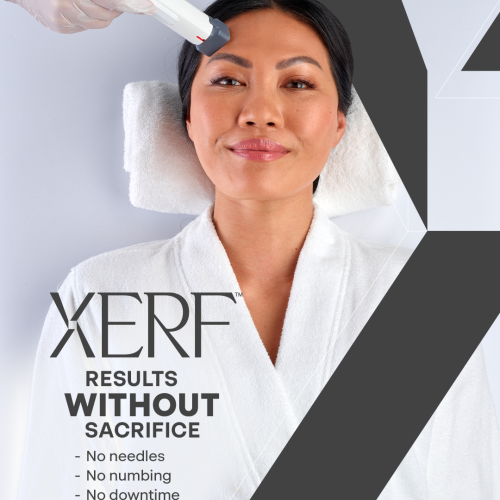 XERF banner
